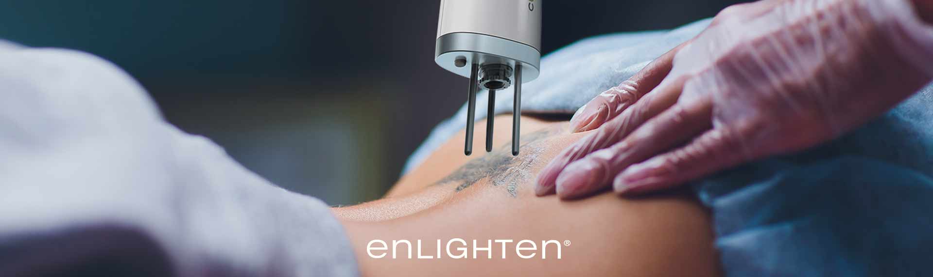 enlighten: How the Best Tattoo Removal Solution Became My Practice's  Workhorse | CUTERA